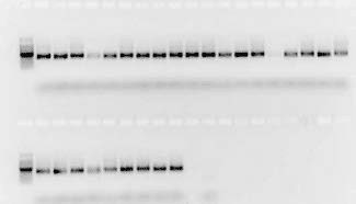 Sample of waterbugs for DNA barcoding